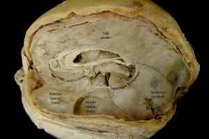 Большой серповидный отросток